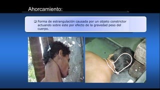 Ahorcamiento:
 Forma de estrangulación causada por un objeto constrictor
actuando sobre este por efecto de la gravedad peso del
cuerpo.
 