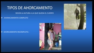 SEGÚN LA ALTURA A LA QUE QUEDA EL CUERPO
 AHORACAMIENTO COMPLETO
 AHORCAMIENTO INCOMPLETO.-
TIPOS DE AHORCAMIENTO
 