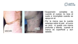 • Suspensión completa es
cuando el cuerpo no toca el
suelo e incompleta cuando se
apoya en el.
• Por la marca que la cuerda
estampa sobre la piel , el surco
es duro si queda una marca
profunda y blando cuando al
marca es superficial y aun
deleble.
 
