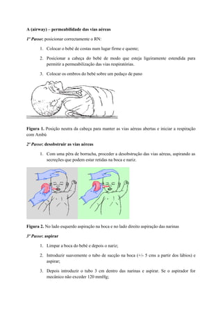 A (airway) – permeabilidade das vias aéreas
1º Passo: posicionar correctamente o RN:
1. Colocar o bebé de costas num lugar firme e quente;
2. Posicionar a cabeça do bebé de modo que esteja ligeiramente estendida para
permitir a permeabilização das vias respiratórias.
3. Colocar os ombros do bebé sobre um pedaço de pano
Figura 1. Posição neutra da cabeça para manter as vias aéreas abertas e iniciar a respiração
com Ambú
2º Passo: desobstruir as vias aéreas
1. Com uma pêra de borracha, proceder a desobstrução das vias aéreas, aspirando as
secreções que podem estar retidas na boca e nariz.
Figura 2. No lado esquerdo aspiração na boca e no lado direito aspiração das narinas
3º Passo: aspirar
1. Limpar a boca do bebé e depois o nariz;
2. Introduzir suavemente o tubo de sucção na boca (+/- 5 cms a partir dos lábios) e
aspirar;
3. Depois introduzir o tubo 3 cm dentro das narinas e aspirar. Se o aspirador for
mecânico não exceder 120 mmHg;
 