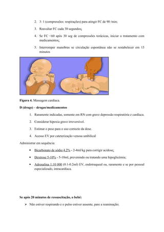 2. 3: 1 (compressões: respirações) para atingir FC de 90 /min;
3. Reavaliar FC cada 30 segundos;
4. Se FC <60 após 30 seg de compressões torácicas, iniciar o tratamento com
medicamentos;
5. Interromper manobras se circulação espontânea não se restabelecer em 15
minutos
Figura 4. Massagem cardíaca.
D (drugs) – drogas/medicamentos
1. Raramente indicadas, somente em RN com grave depressão respiratória e cardíaca.
2. Considerar hipoxia grave irreversível.
3. Estimar o peso para o uso correcto da dose.
4. Acesso EV por cateterização venosa umbilical
Administrar em sequência:
 Bicarbonato de sódio 4.2% - 2-4ml/kg para corrigir acidose;
 Dextrose 5-10% - 5-10ml, prevenindo ou tratando uma hipoglicémia;
 Adrenalina 1:10 000 (0.1-0.2ml) EV, endotraqueal ou, raramente e se por pessoal
especializado, intracardíaca.
Se após 20 minutos de ressuscitação, o bebé:
 Não estiver respirando e o pulso estiver ausente, pare a reanimação;
 