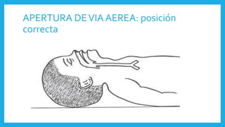 APERTURA DEVIA AEREA: posición
correcta
 