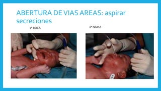 ABERTURA DEVIAS AREAS: aspirar
secreciones
1° BOCA 2° NARIZ
 