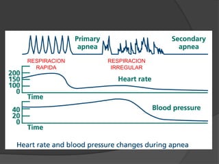 RESPIRACION   RESPIRACION
  RAPIDA       IRREGULAR
 