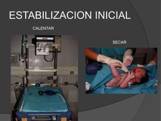 ESTABILIZACION INICIAL
    CALENTAR


                  SECAR
 