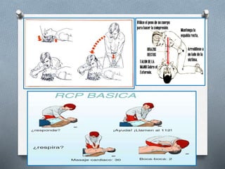 Asfixia por sumersion
