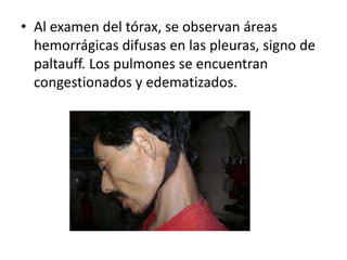 • Al examen del tórax, se observan áreas
hemorrágicas difusas en las pleuras, signo de
paltauff. Los pulmones se encuentran
congestionados y edematizados.
 