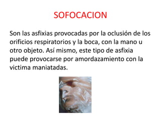 SOFOCACION
Son las asfixias provocadas por la oclusión de los
orificios respiratorios y la boca, con la mano u
otro objeto. Así mismo, este tipo de asfixia
puede provocarse por amordazamiento con la
victima maniatadas.
 