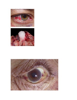 Asfixias+ esquema---