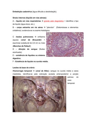 Embebição cadavérica (água dificulta a desidratação).
Sinais internos (líquido em vias aéreas):
A – líquido em vias respiratórias  grande valor diagnóstico + identifica o tipo
de líquido (água doce, etc.);
B – corpo estranho em via aérea  “plancton” (Diatomáceas e elementos
cristalinos): evidencia-se no exame histológico;
C –lesões pulmonares  enfisema
aquoso (sinal de Brouardel) +
equimose subpleural de 2,0 cm ou mais
(Manchas de Paltauf);
D – diluição do sangue (fluidez
acentuada);
E – existência de líquidos no sistema
digestivo;
F - Existência de líquido no ouvido médio.
Lesões da base do crânio:
#hemorragia temporal  (sinal de Niles): sangue no ouvido médio e seios
mastóides, identifica-se pela coloração azulada anteroposterior a porção
petroso do
osso
temporal.
 