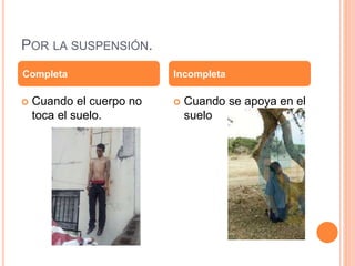 POR LA SUSPENSIÓN.
 Cuando el cuerpo no
toca el suelo.
 Cuando se apoya en el
suelo
Completa Incompleta
 