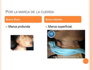 POR LA MARCA DE LA CUERDA
 Marca profunda  Marca superficial.
Surco Duro Surco blando.
 