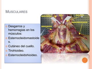 MUSCULARES
 Desgarros y
hemorragias en los
músculos:
 Esternocleidomastoide
s.
 Cutáneo del cuello.
 Tirohioideo.
 Esternocleidohioideo.
 