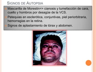 SIGNOS DE AUTOPSIA
 Mascarilla de Morestin=> cianosis y tumefacción de cara,
cuello y hombros por desagüe de la VCS.
 Petequias en esclerótica, conjuntivas, piel periorbitraria,
hemorragias en la retina.
 Signos de aplastamiento de tórax y abdomen.
 