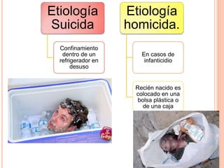 Etiología
Suicida
Confinamiento
dentro de un
refrigerador en
desuso
Etiología
homicida.
En casos de
infanticidio
Recién nacido es
colocado en una
bolsa plástica o
de una caja
 