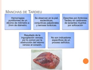 MANCHAS DE TARDIEU
Hemorragias
puntiformes de un
décimo de milímetro a
2mm de diámetro.
Se observan en la piel,
escleróticas,
conjuntivas palpebrales
y serosas torácicas.
Descritas por Ambroise
Tardieu en cadáveres
de lactantes muertos
por sofocación
Resultado de la
ingurgitación venosa,
por lo común por la
obstrucción del retorno
venoso al corazón.
No son indicadores
específicos de un
proceso asfíctico.
 
