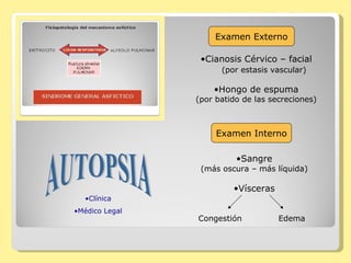 Examen Externo Cianosis Cérvico – facial (por estasis vascular) Hongo de espuma (por batido de las secreciones) Examen Interno Sangre (más oscura – más líquida) Vísceras Congestión Edema AUTOPSIA Clínica Médico Legal 