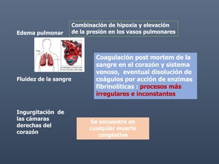 Edema pulmonar
Fluidez de la sangre
Ingurgitación de
las cámaras
derechas del
corazón
Combinación de hipoxia y elevación
de la presión en los vasos pulmonares
Coagulación post mortem de la
sangre en el corazón y sistema
venoso, eventual disolución de
coágulos por acción de enzimas
fibrinolíticas : procesos más
irregulares e inconstantes
Se encuentra en
cualquier muerte
congéstiva
 