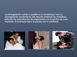 La estrangulación suicida es posible en la variedad por lazo. La
estrangulación accidental ha sido descrita mediante las maniobras
policiales de inmovilización de sospechosos y en la practica de artes
marciales. El victimario ejerce la presión con su antebrazo.
 