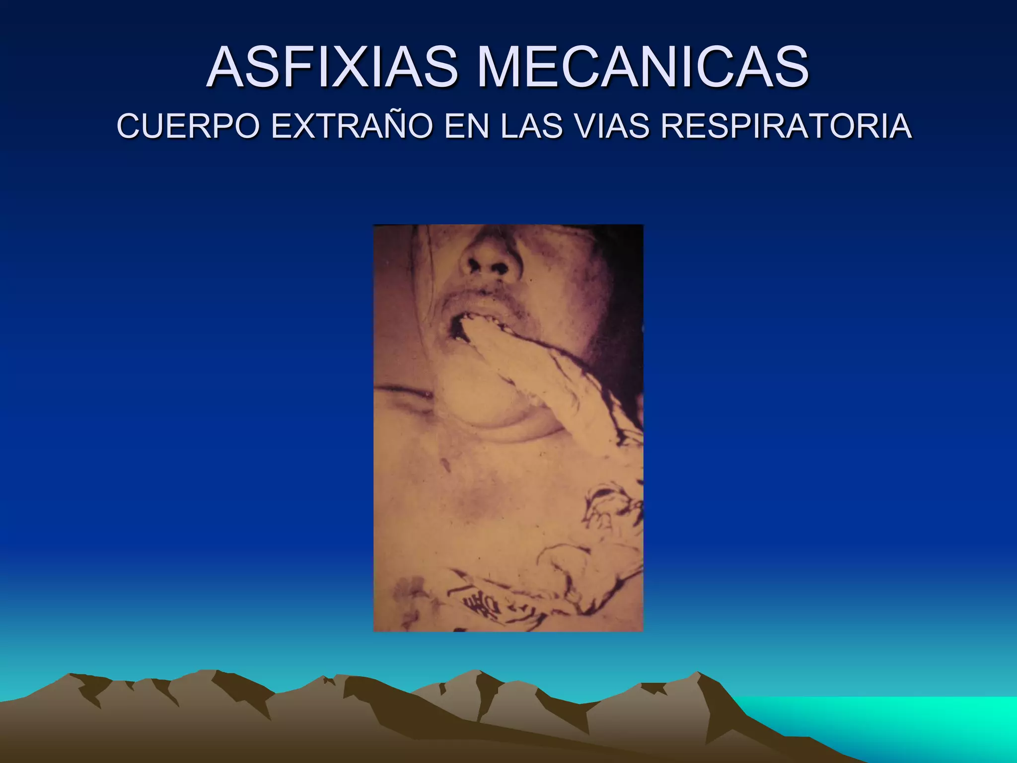 Asfixias mecanicas | PPT