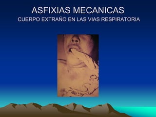 ASFIXIAS MECANICAS
CUERPO EXTRAÑO EN LAS VIAS RESPIRATORIA
 