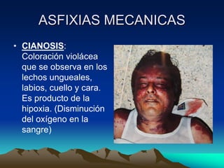ASFIXIAS MECANICAS
• CIANOSIS:
  Coloración violácea
  que se observa en los
  lechos ungueales,
  labios, cuello y cara.
  Es producto de la
  hipoxia. (Disminución
  del oxígeno en la
  sangre)
 