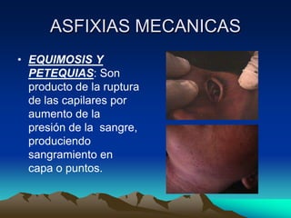 ASFIXIAS MECANICAS
• EQUIMOSIS Y
  PETEQUIAS: Son
  producto de la ruptura
  de las capilares por
  aumento de la
  presión de la sangre,
  produciendo
  sangramiento en
  capa o puntos.
 