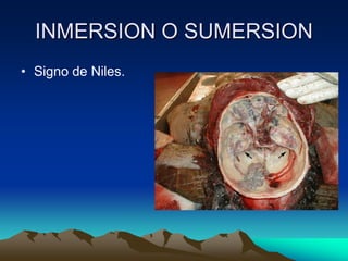 INMERSION O SUMERSION
• Signo de Niles.
 
