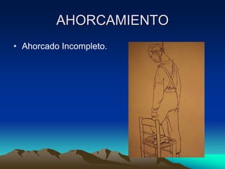 AHORCAMIENTO
• Ahorcado Incompleto.
 