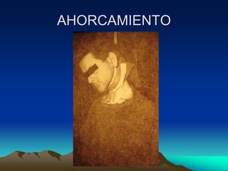 AHORCAMIENTO
 