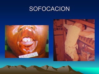 SOFOCACION
 