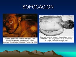 SOFOCACION
 