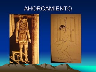 AHORCAMIENTO
 