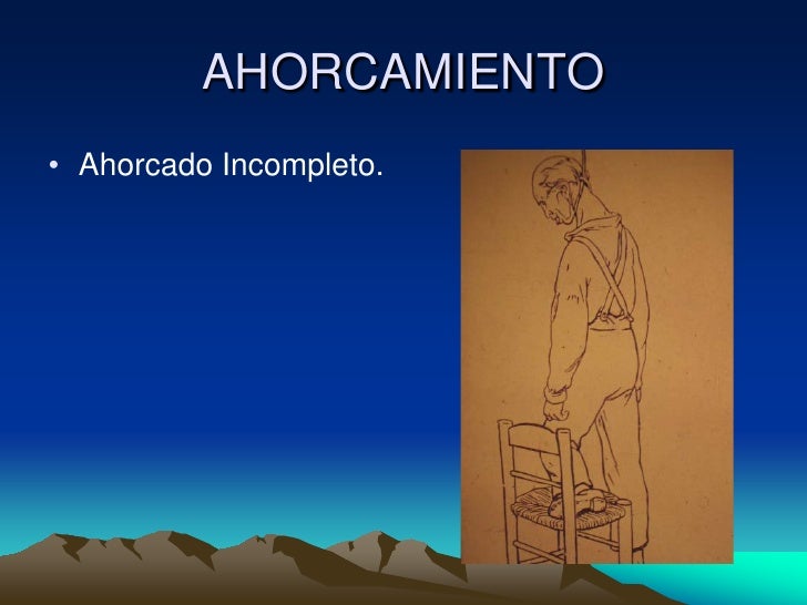 AHORCAMIENTO• Ahorcado Incompleto.