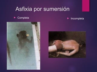 Asfixia por sumersión 
 Completa  Incompleta 
 