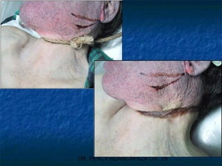 DR. PERCY HUANCAPAZA CH. 29
 