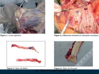 DR. PERCY HUANCAPAZA CH. 36
 