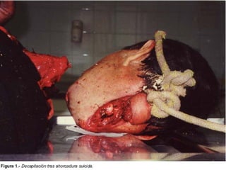 DR. PERCY HUANCAPAZA CH. 38
 