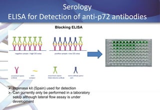 Serology
ELISA for Detection of anti-p72 antibodies
Blocking ELISA

 Ingenasa kit (Spain) used for detection
 Can currently only be performed in a laboratory
setup although lateral flow assay is under
development

 