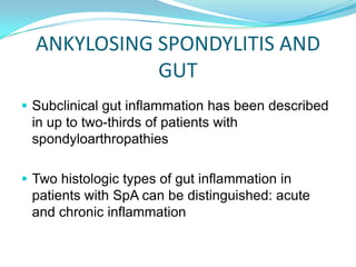 ANKYLOSING SPONDYLITIS AND
GUT
 Subclinical gut inflammation has been described
in up to two-thirds of patients with
spon...
