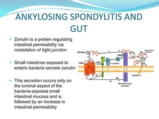Ankylosing Spondylitis the gut and the bugs: an integrative approach to treatment