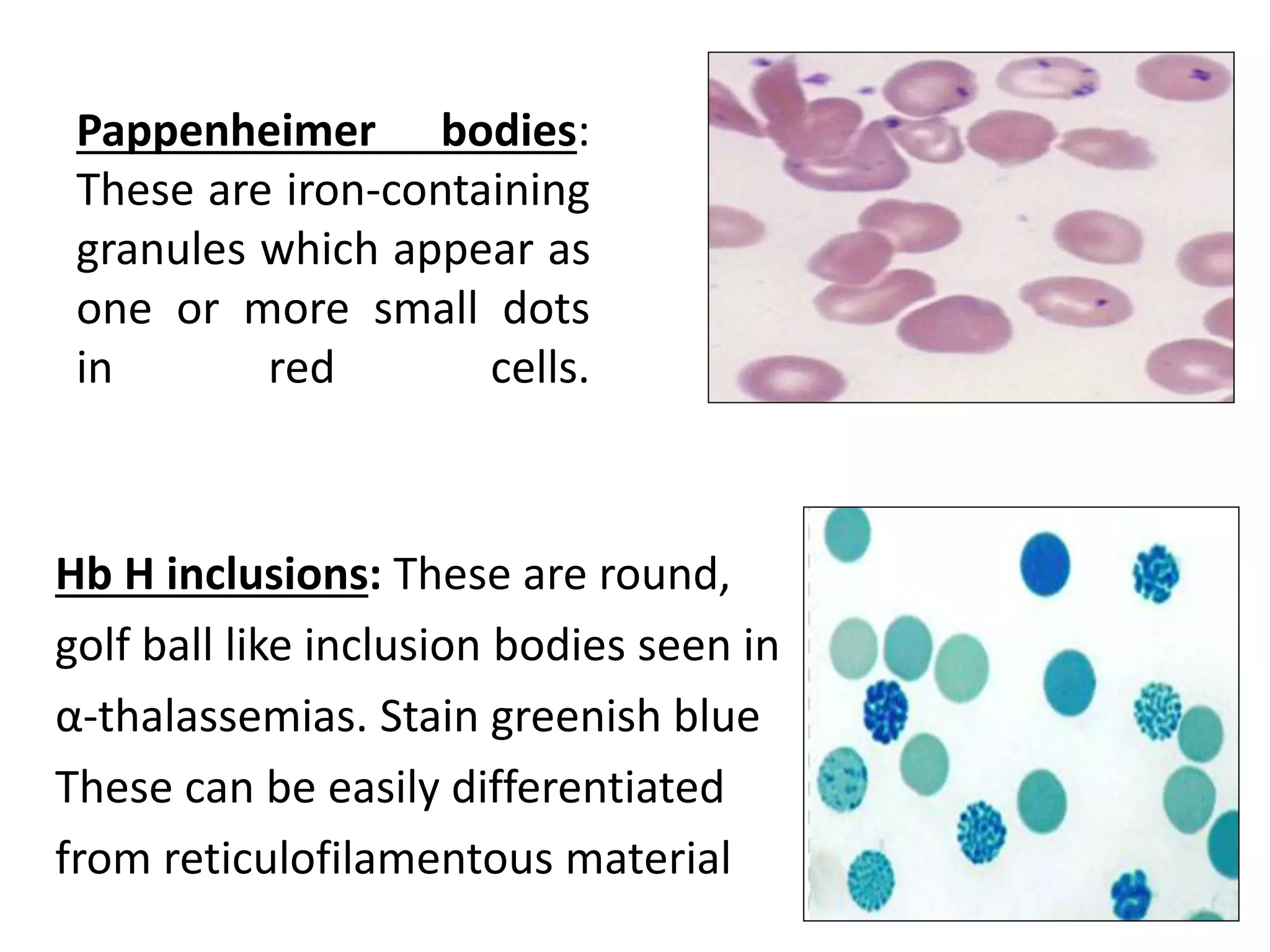 reticulocyte.pptx