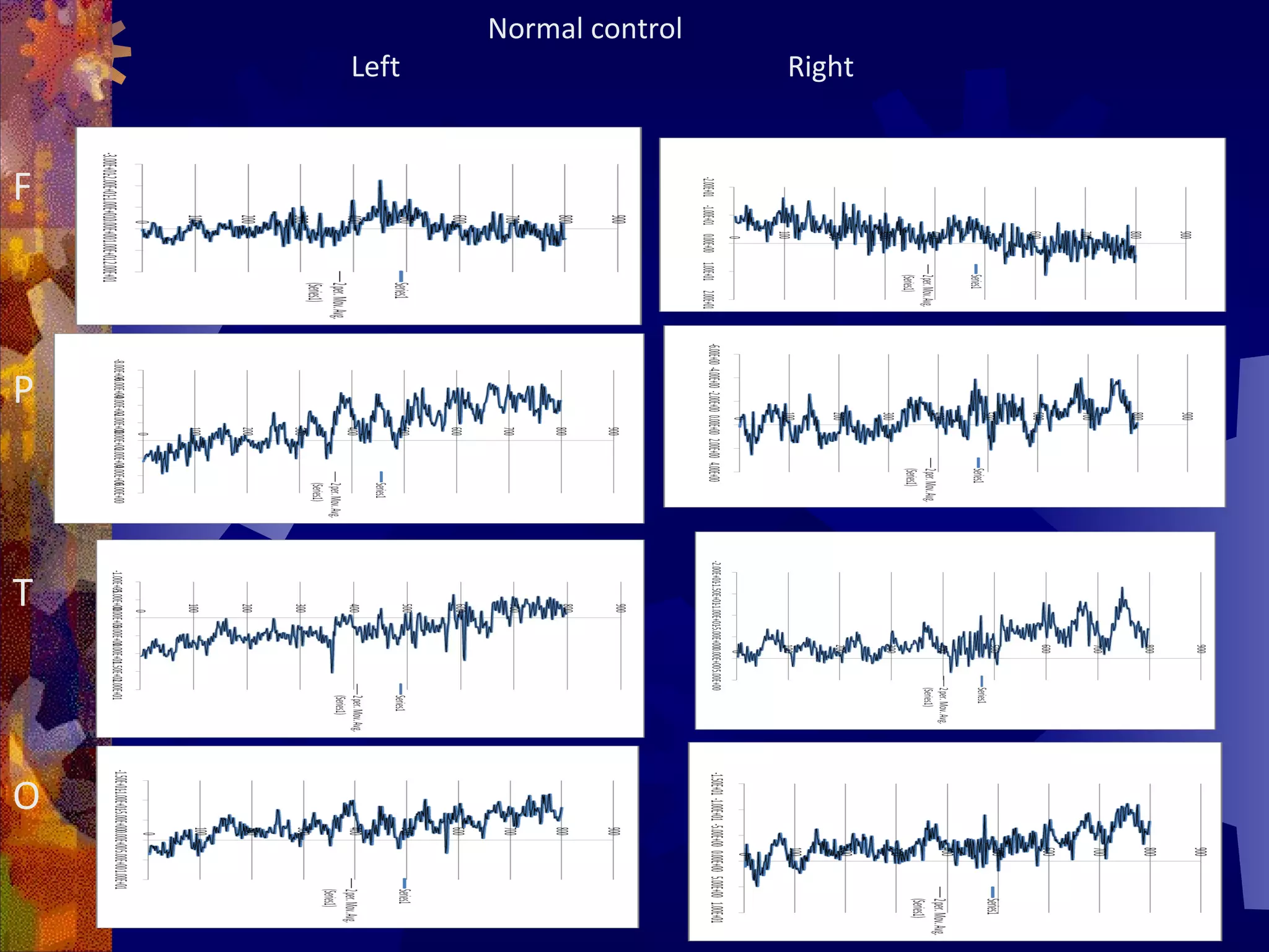 Normal control
    Left                    Right


F



P



T



O
 