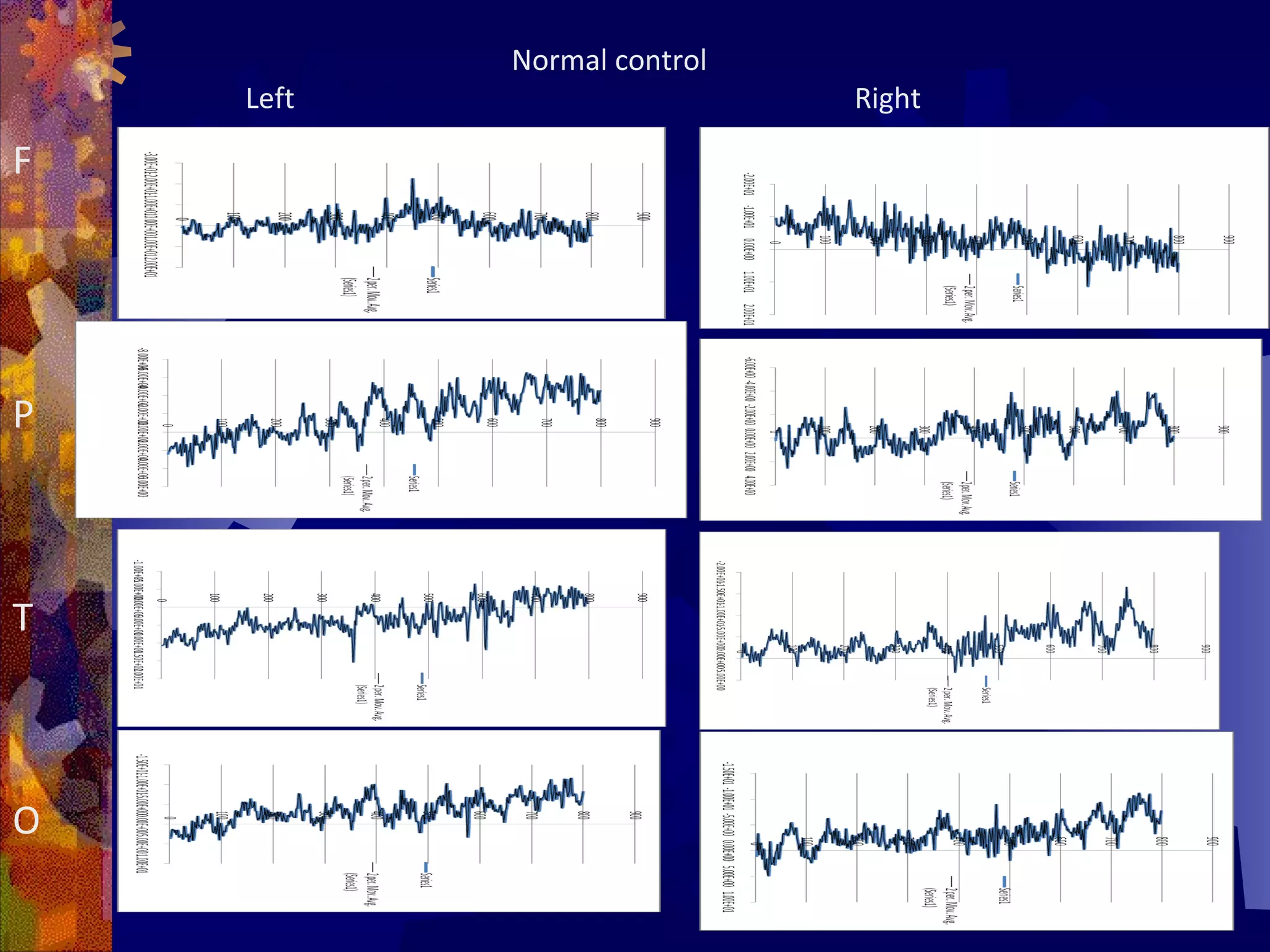 Normal control
    Left                    Right

F




P



T



O
 