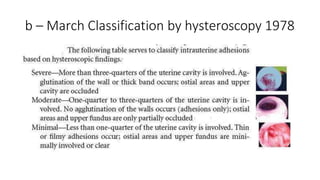 March Classification ashermansyndrome-180121233706.pptx