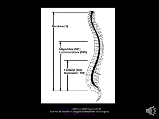 Anesth Analg. 2005 Nov;101(5 Suppl):S30-43.
The role of intrathecal drugs in the treatment of acute pain.
Rathmell JP1, Lair TR, Nauman B
 