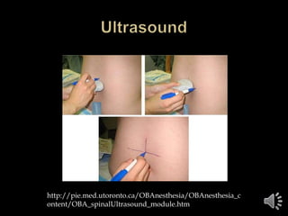 http://pie.med.utoronto.ca/OBAnesthesia/OBAnesthesia_c
ontent/OBA_spinalUltrasound_module.htm
 