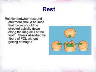 Continuous Rest Rpd biomechanics in rpd | PPT