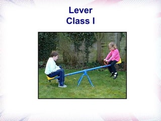 Lever System Rpd biomechanics in rpd | PPT