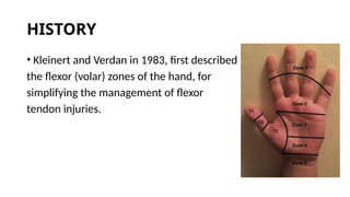 Verdan Classification The zones of the hand flexor refer to anatomical areas of the hand ...